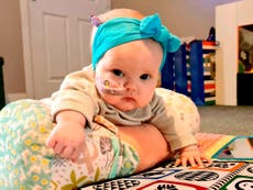 Toddler with brain tumour ‘hours from death’ after doctors dismissed swollen head as ‘normal baby stuff’