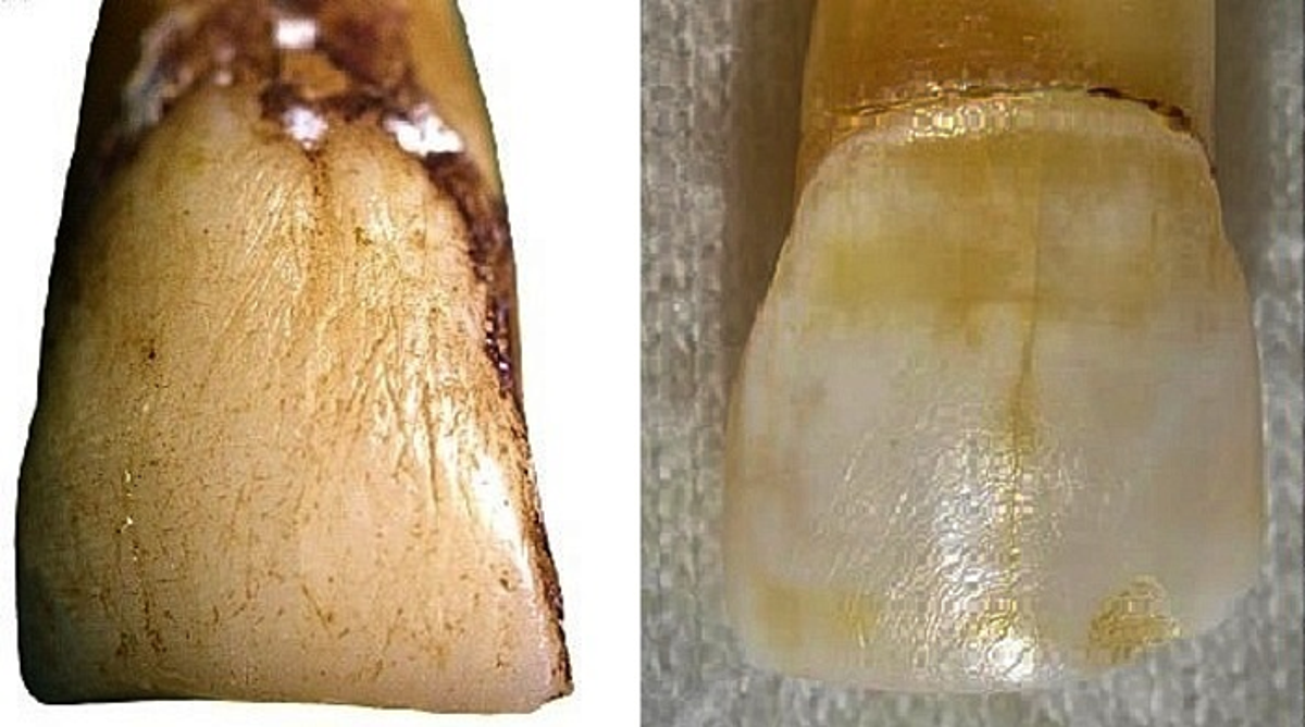 科学者たちは、日本の類人猿の歯の奇妙なマーキングが人類の進化の再考を促すかもしれないと言います