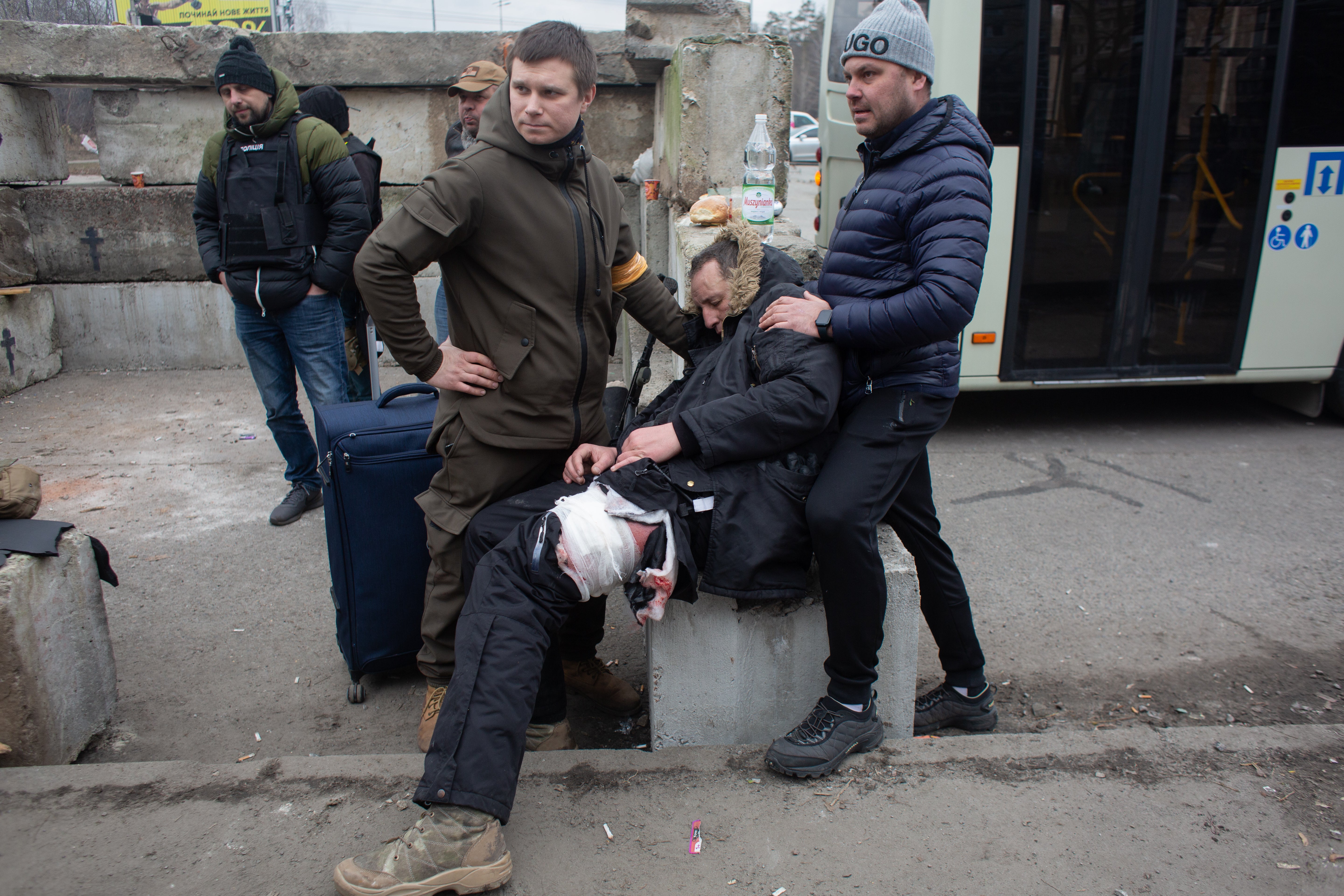 Yuriy, who who was shot in the leg while evacuating civilians from the shelled city of Irpin receives first aid in Kyiv.