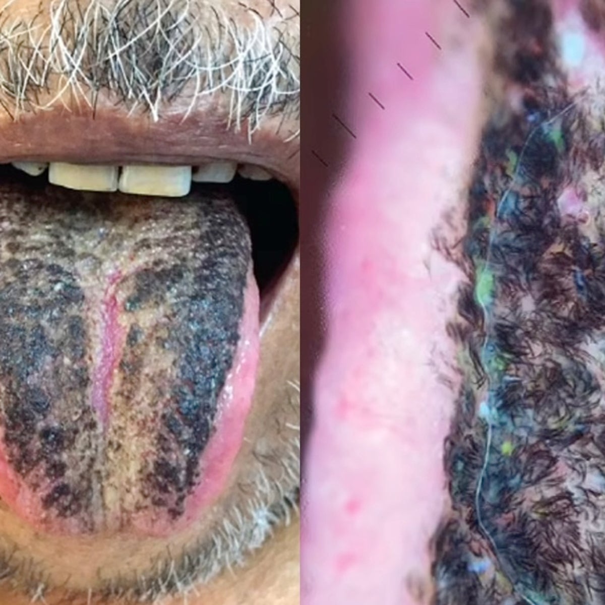 three carcinogens found in smokeless tobacco products SLTChemDB: A database of chemical compounds present in Smokeless tobacco products three carcinogens found in smokeless tobacco products SLTChemDB: A database of chemical compounds present in Smokeless tobacco products