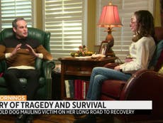 Texas student whose face was ripped off by two rescue dogs reveals injuries: ‘It’s time to show who I am now’ 