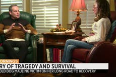 Texas student whose face was ripped off by two rescue dogs reveals injuries: ‘It’s time to show who I am now’