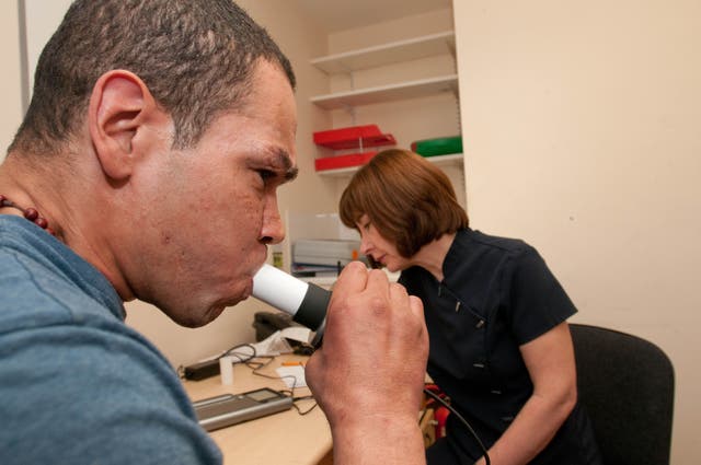 People are being urged not to dismiss a cough as Covid after figures showed a rise in cases of tuberculosis (Alamy/PA)