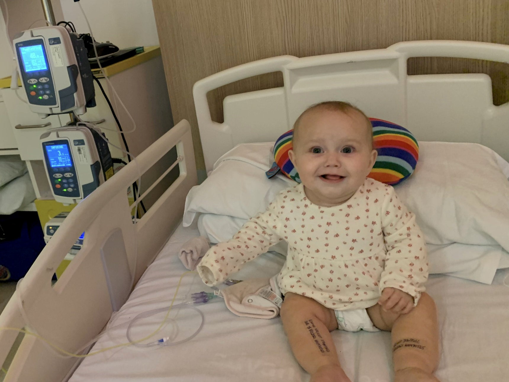 Baby Esmai is currently undergoing chemotherapy for her brain tumour