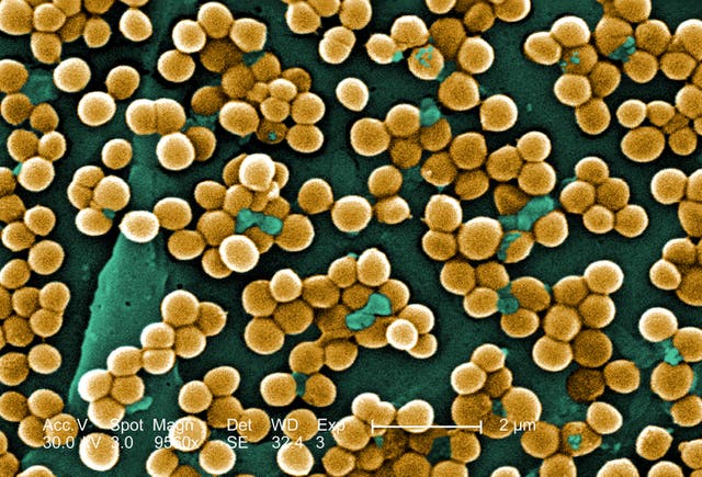 A photograph of the MRSA bacteria (PA)