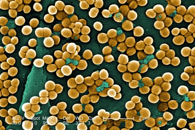 A photograph of the MRSA bacteria (PA)