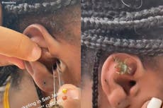 Woman shares moment crab was removed from her ear after snorkelling: ‘Screaming in my soul’