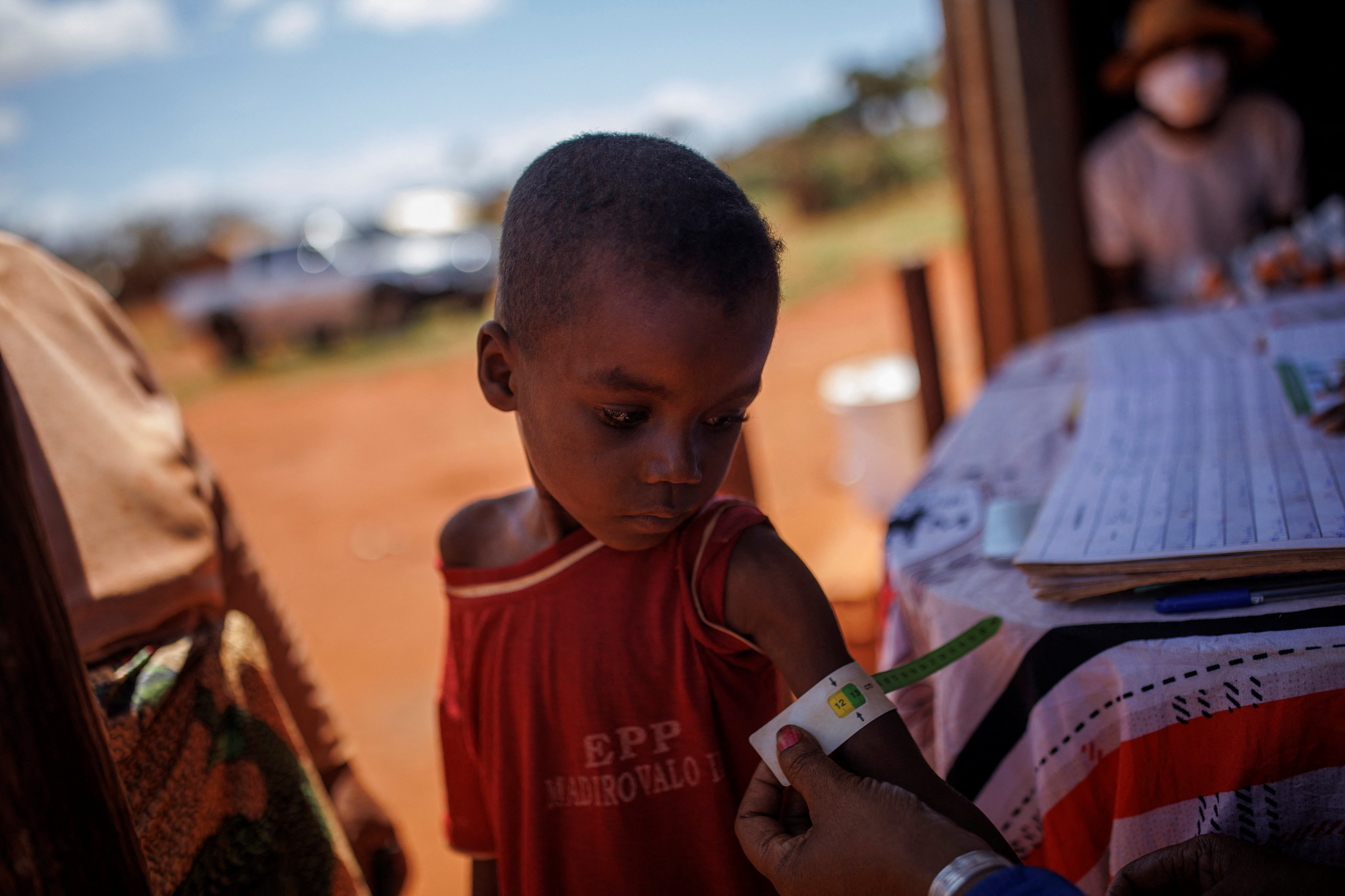 Avoraza is examined at a children’s malnutrition post run by the World Food Programme