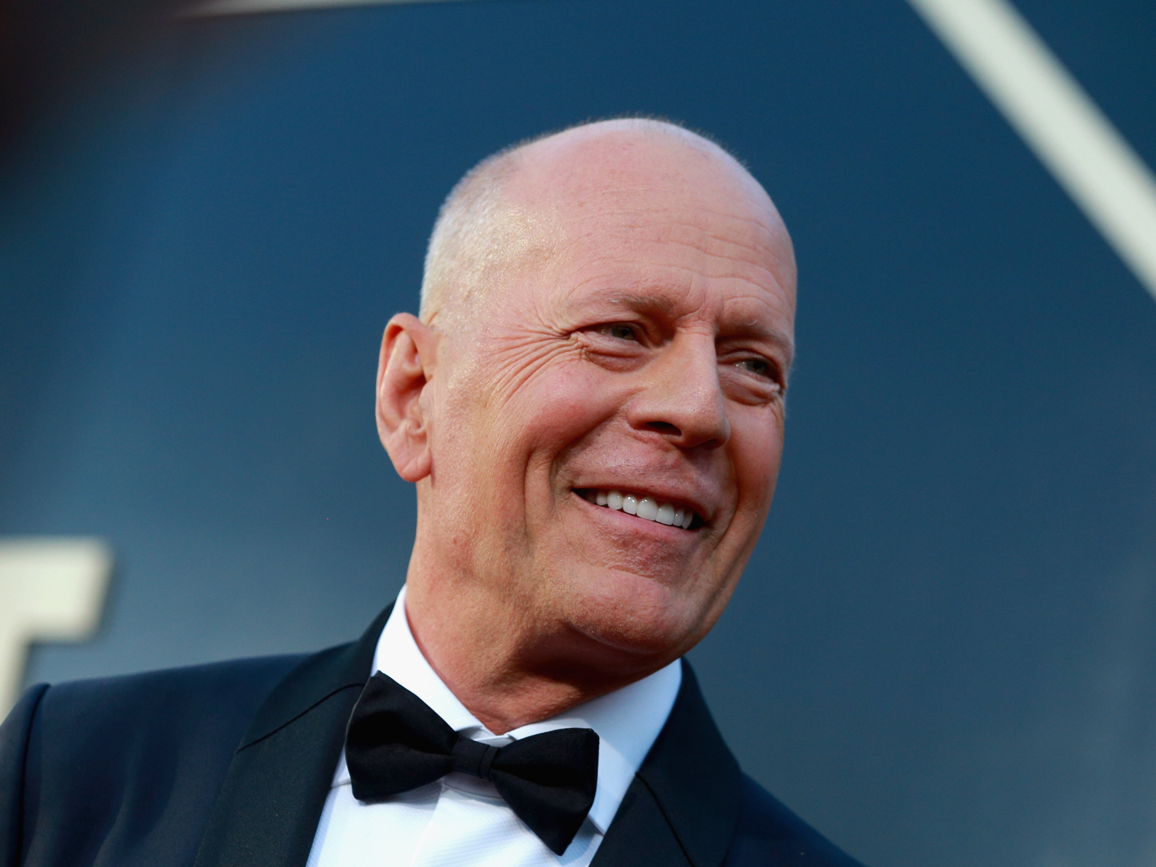 Bruce Willis is ‘stepping away’ from acting after aphasia diagnosis
