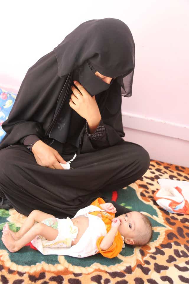 <p>Sana al-Hamidi’s newborn son is being treated for acute malnourishment at al-Sabaeen hospital in Yemen’s capital, Sana’a </p>