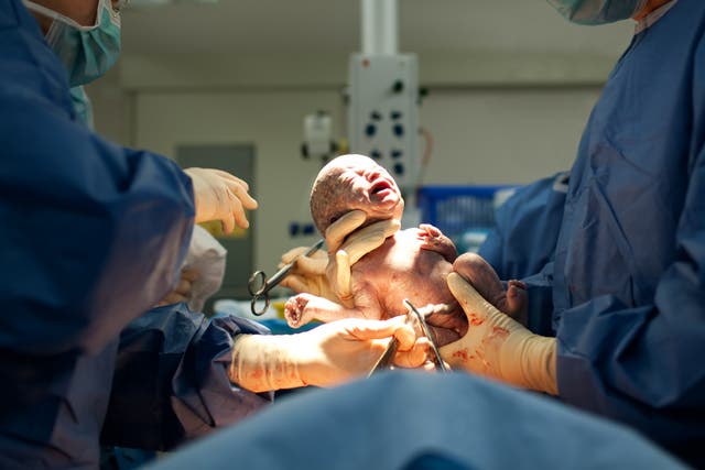 <p>The truth is that caesarean sections are not simply ‘failures’ of vaginal births – and women’s reasons for choosing them are both universally valid and incredibly diverse</p>