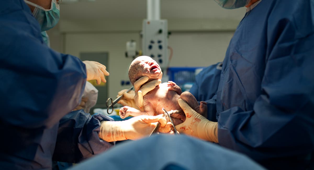 Why we must call time on damaging anti-caesarean birth stigma