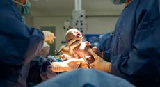 Too posh to push: Why we must call time on damaging anti-caesarean birth stigma