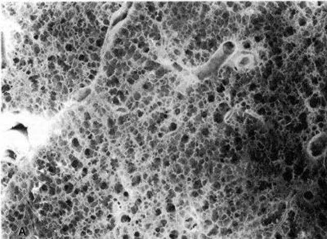 <p>Image shows the normal lung tissue of a healthy patient</p>