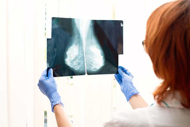 The new data on Lynparza is being presented at the European Society for Medical Oncology congress (Alamy/PA)