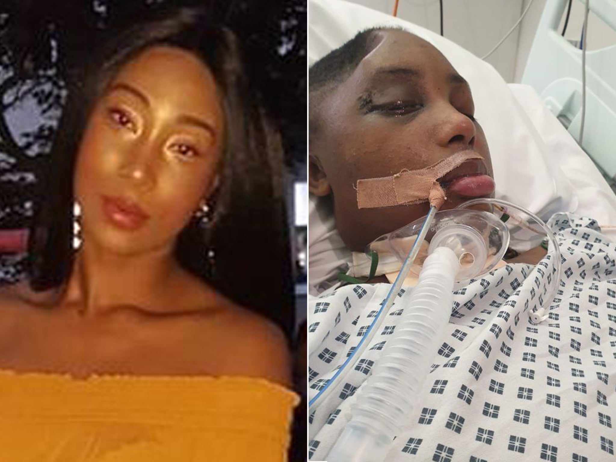 Sasha Johnson was injured when masked people stormed into a party in Peckham last year