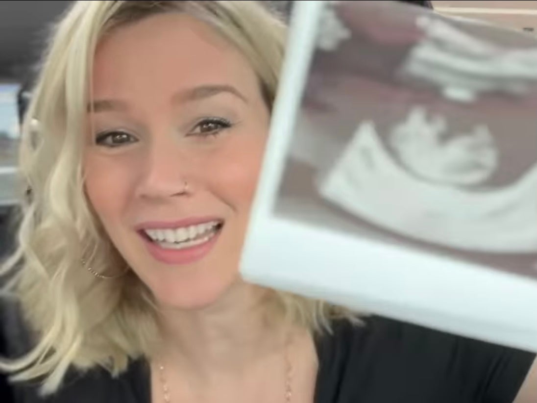 Watch: Joss Stone gives update on pregnancy so far