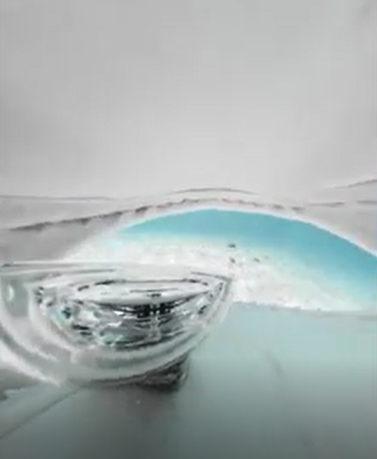 The inside of the mouth captured by cinematographer’s Insta360 camera