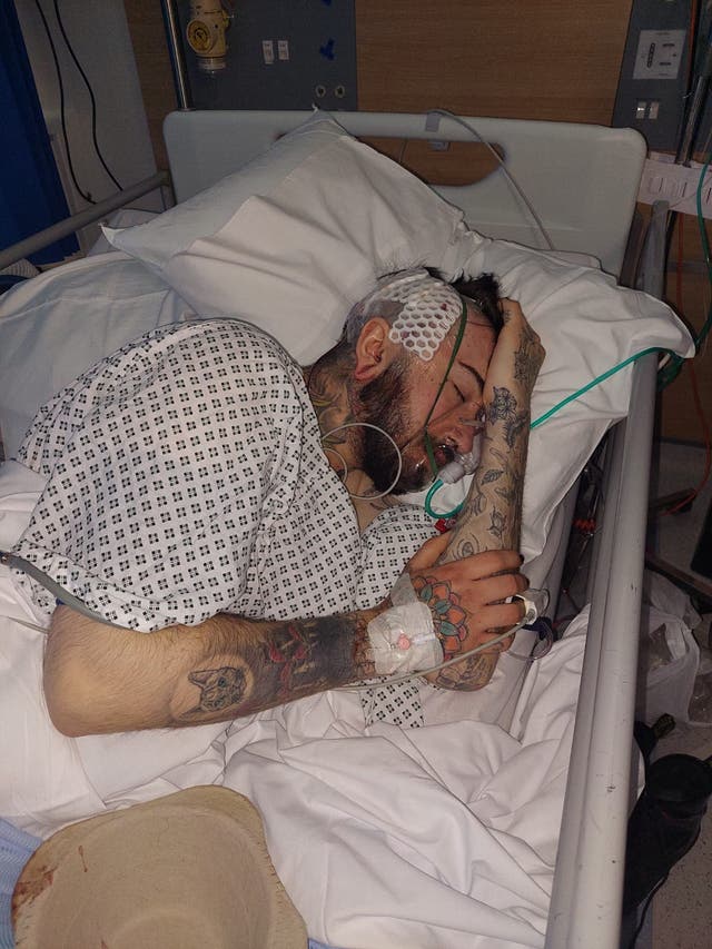 The father of a man left in hospital after a homophobic attack has described the “absolutely devastating” effect it has had on his son and family (Paul Fevre/PA)