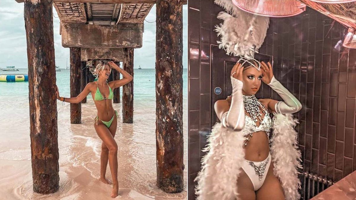 Sun-worshipping dancer diagnosed with skin cancer reveals the warning sign everyone should know