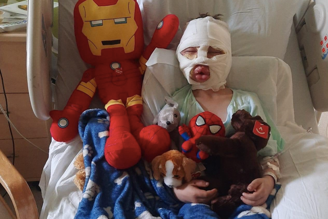 <p>Dominick Krankall, 6, was set on fire by bullies in  Bridgeport, Connecticut and left with second and third-degree burns covering his small frame, his family says</p>