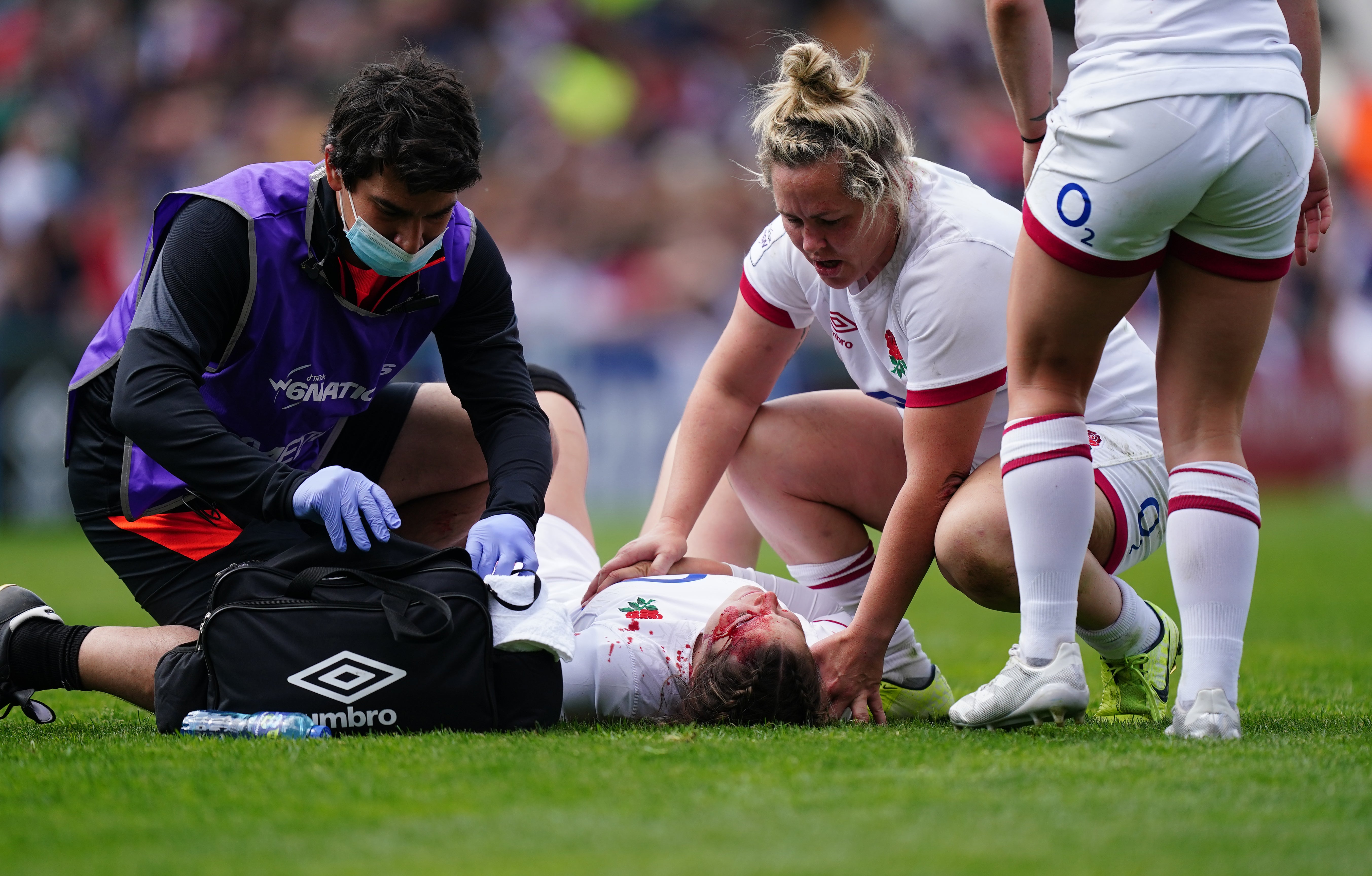 Jess Breach receives treatment at Welford Road for the wound to her forehead (Mike Egerton/PA)