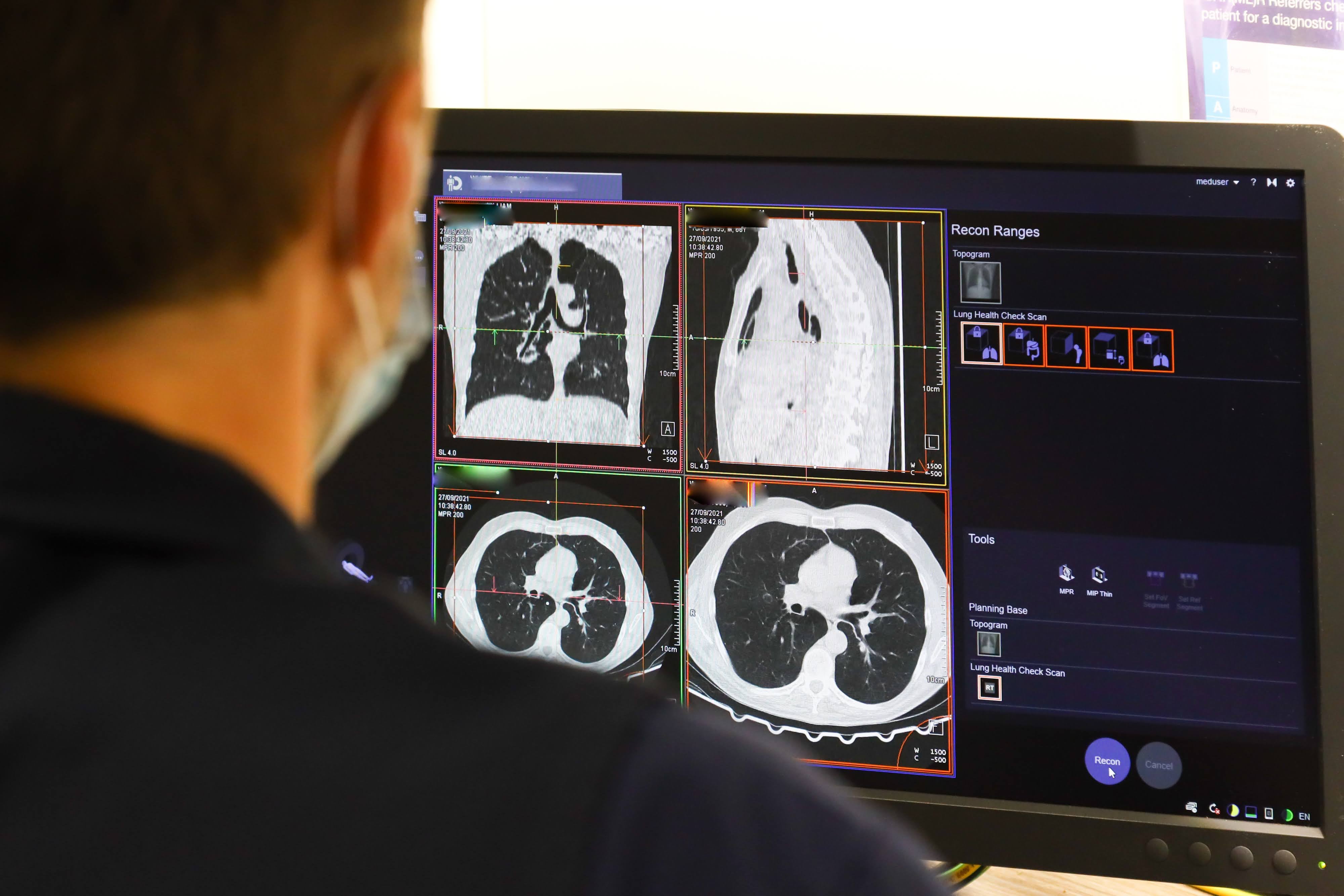 NHS staff looking at the results of a lung scan