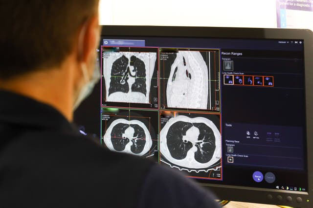 <p>Photo issued by NHS England of a member of staff looking at the results of a lung scan</p>