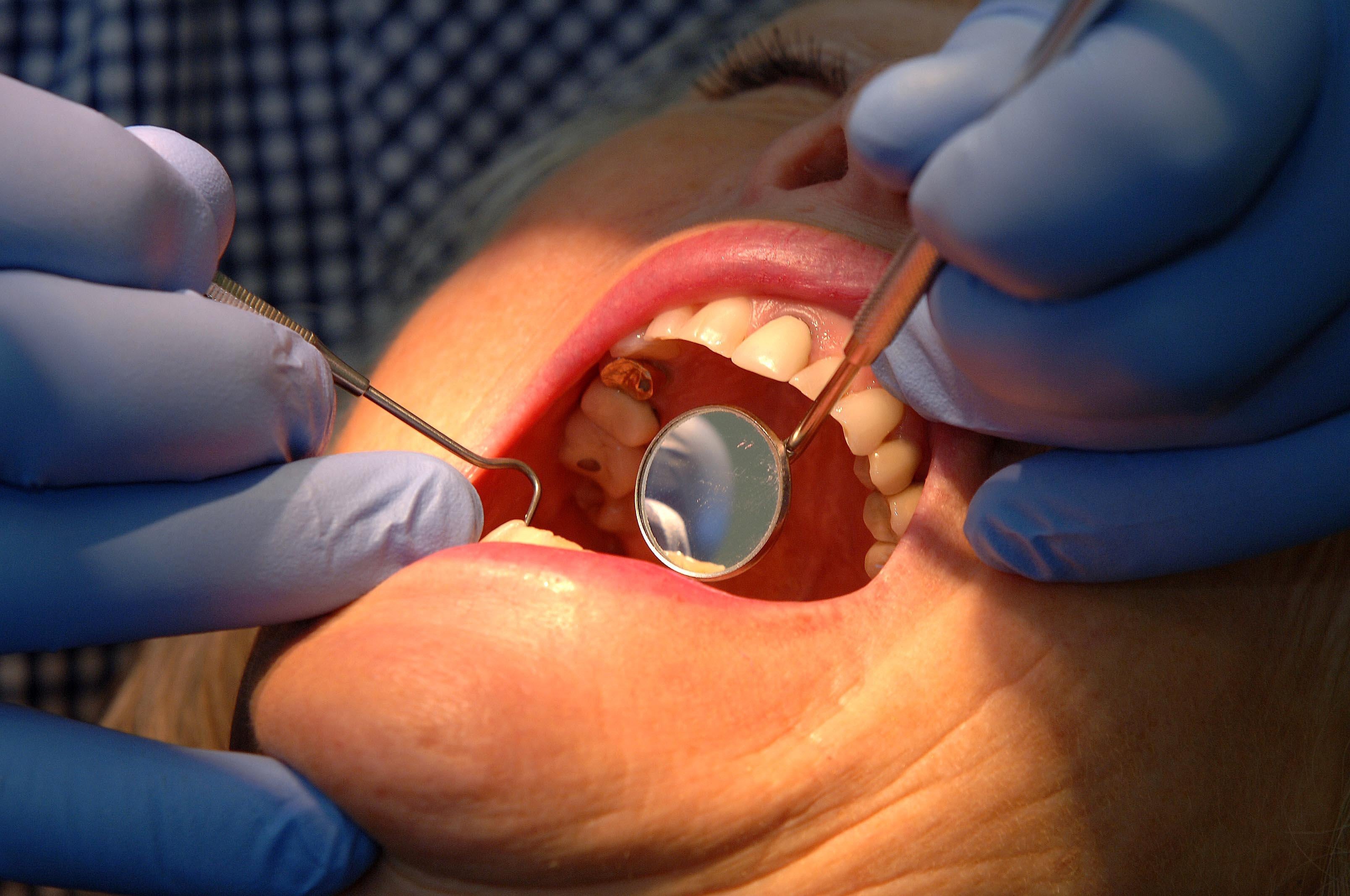 Some patients have reported being unable to find an NHS dentist within a two-hour radius of their home