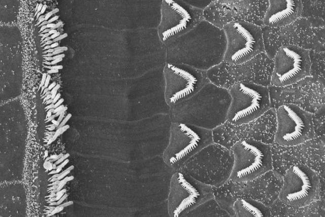 <p>Scanning electron microscope image of the hair bundles of inner and outer hair cells from the mouse cochlea</p>