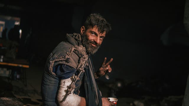 UCRANIA-GUERRA-HERIDOS