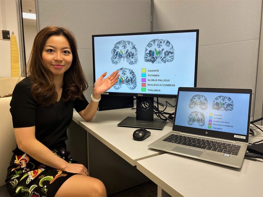 <p>Assistant Professor Olivia Choy, a neuroscientist from NTU’s School of Social Sciences, presenting diagrams of the human striatum</p>