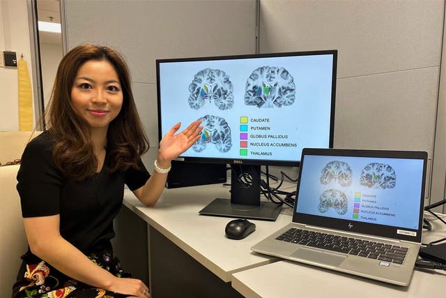 <p>Assistant Professor Olivia Choy, a neuroscientist from NTU’s School of Social Sciences, presenting diagrams of the human striatum</p>