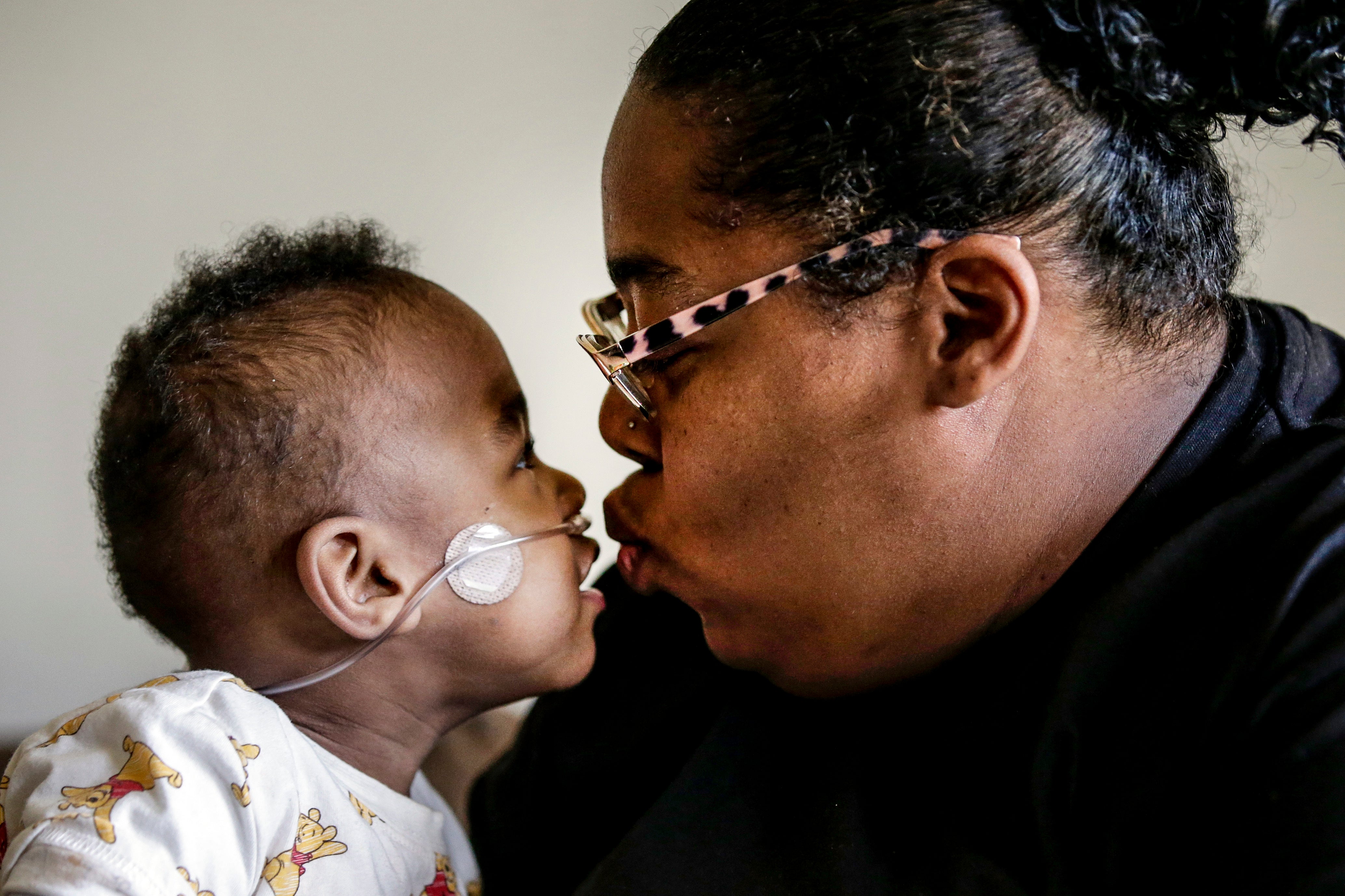 APTOPIX Viability Babies