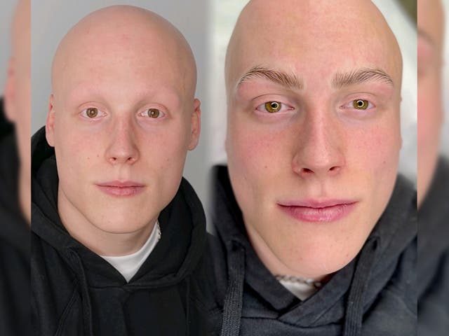 <p>Sam before and after his eyebrow treatment </p>