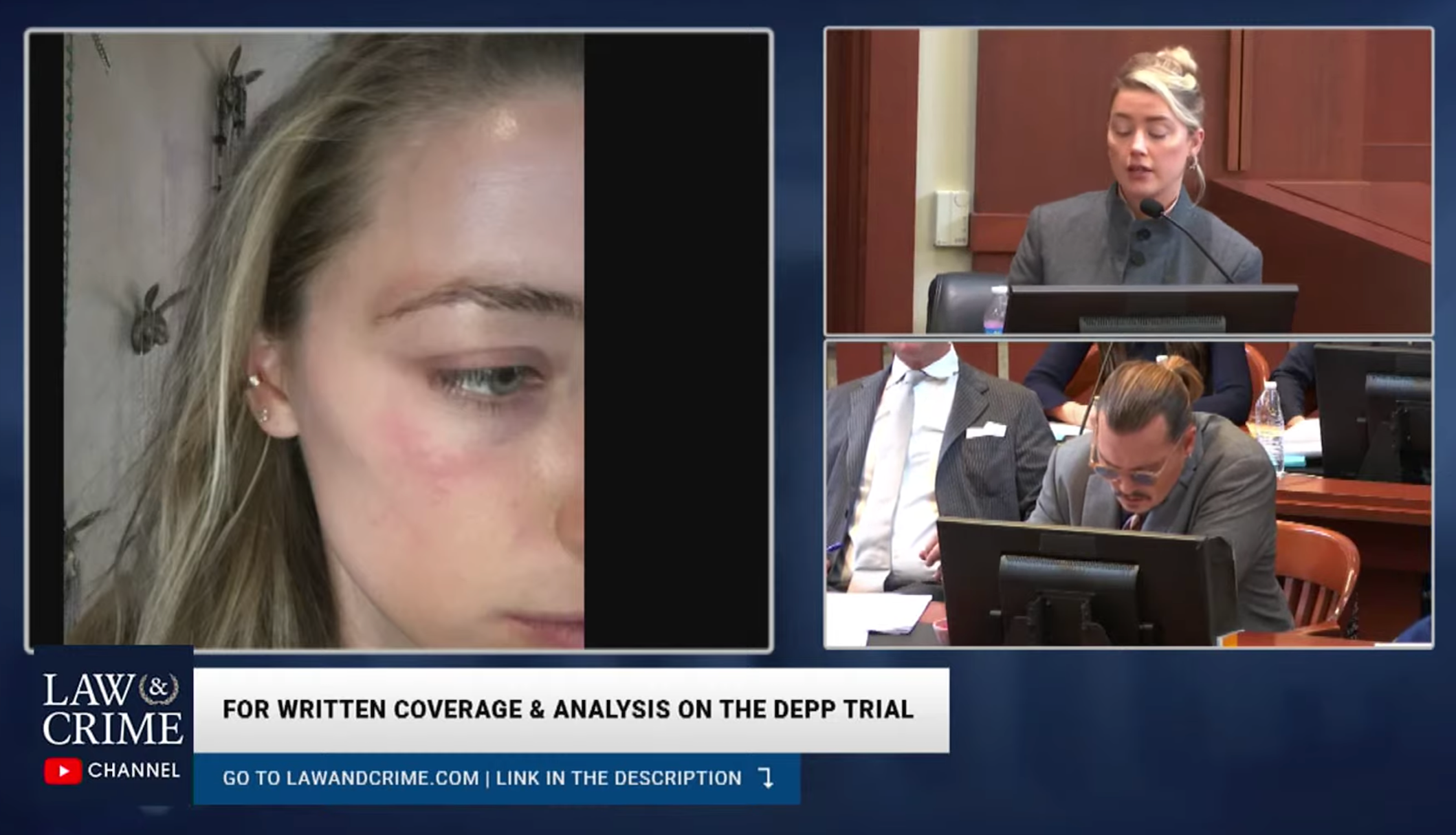 The jury was shown photos of Amber Heard’s face as evidence