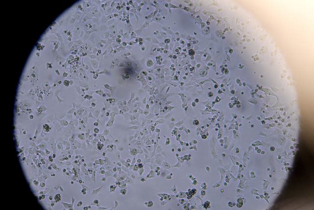 <p>Células que contienen el nuevo coronavirus Sars-CoV-2 vistas en el microscopio</p>