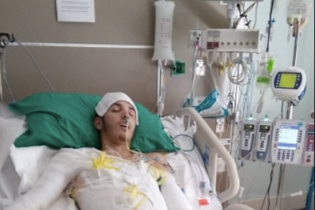 <p>Jean Barreto, 26, suffered third-degree burns on 75 per cent of his body after he was lit on fire from a sheriff deputy tasering him while he was pumping gas in Florida</p>