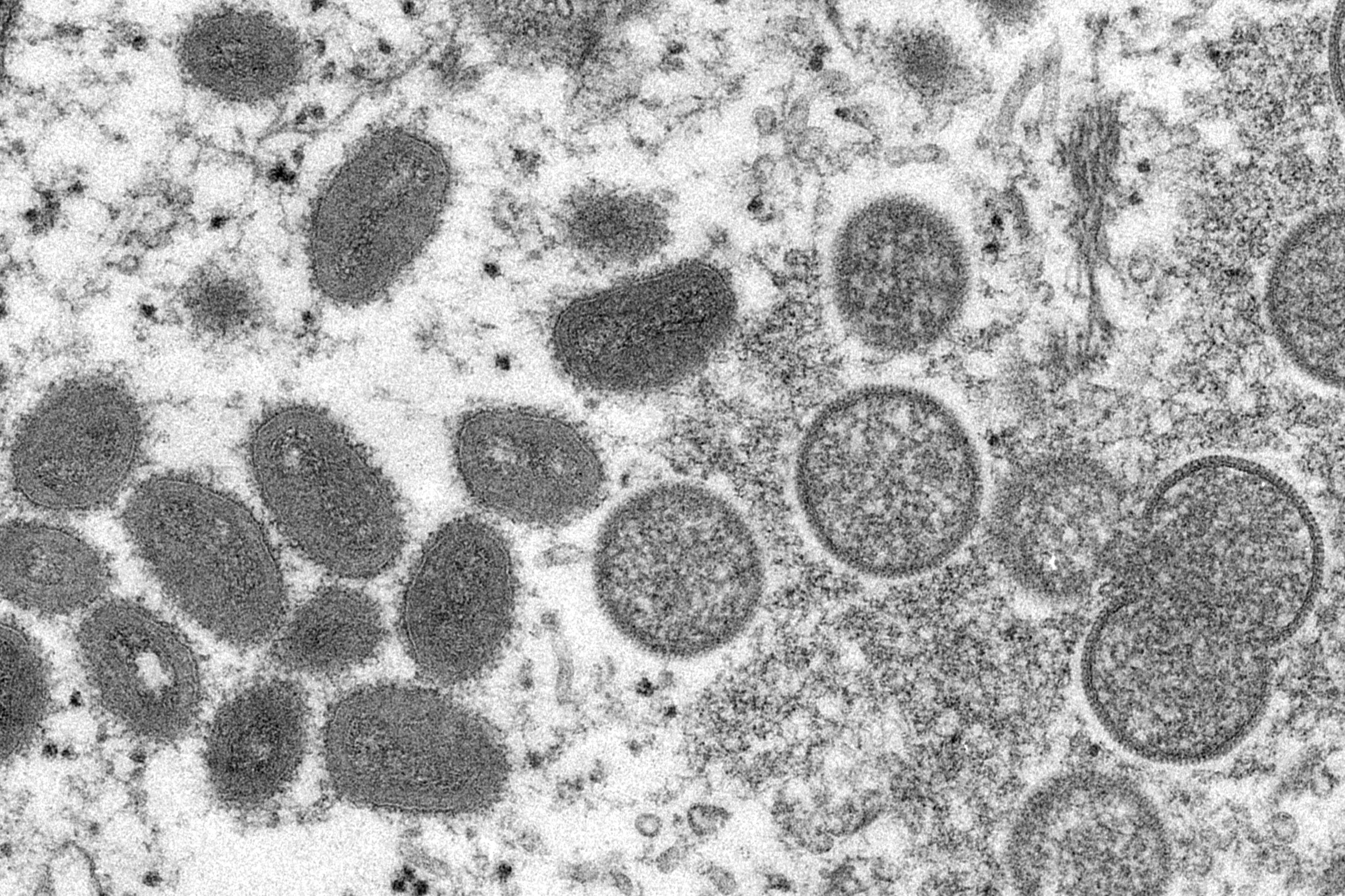 Electron microscope image from 200 showing mature, oval-shaped monkeypox virions