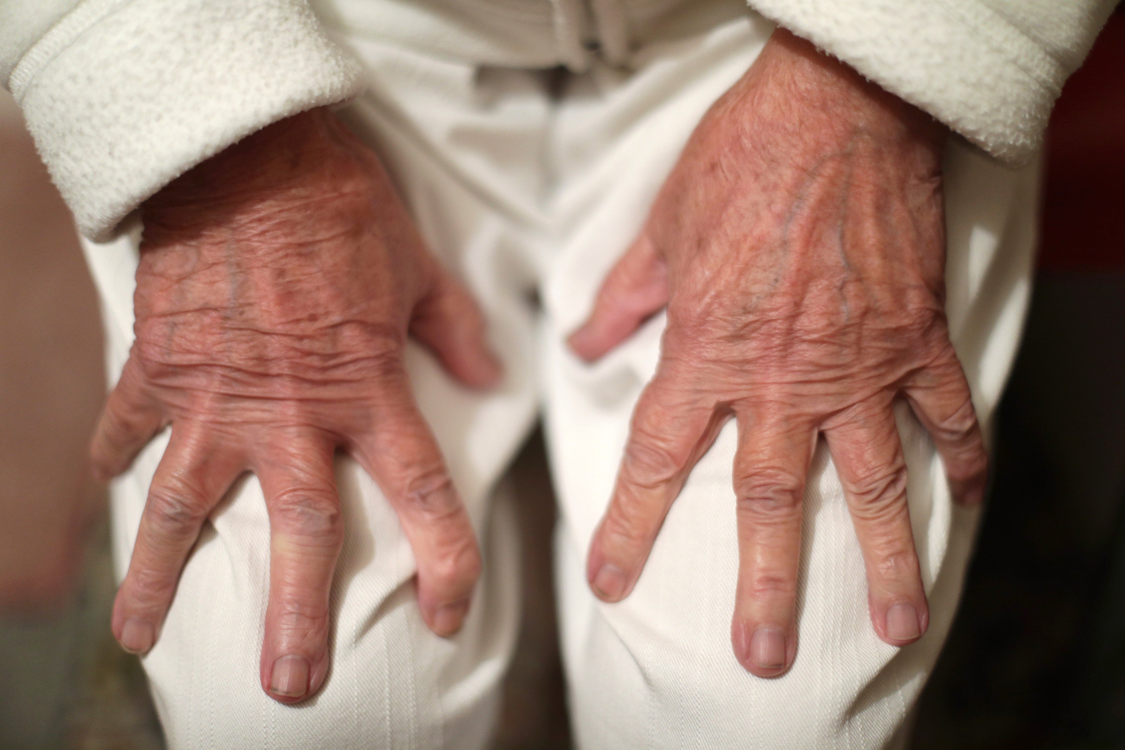 Risk factors for dementia may vary with age, study suggests (Yui Mok/PA)