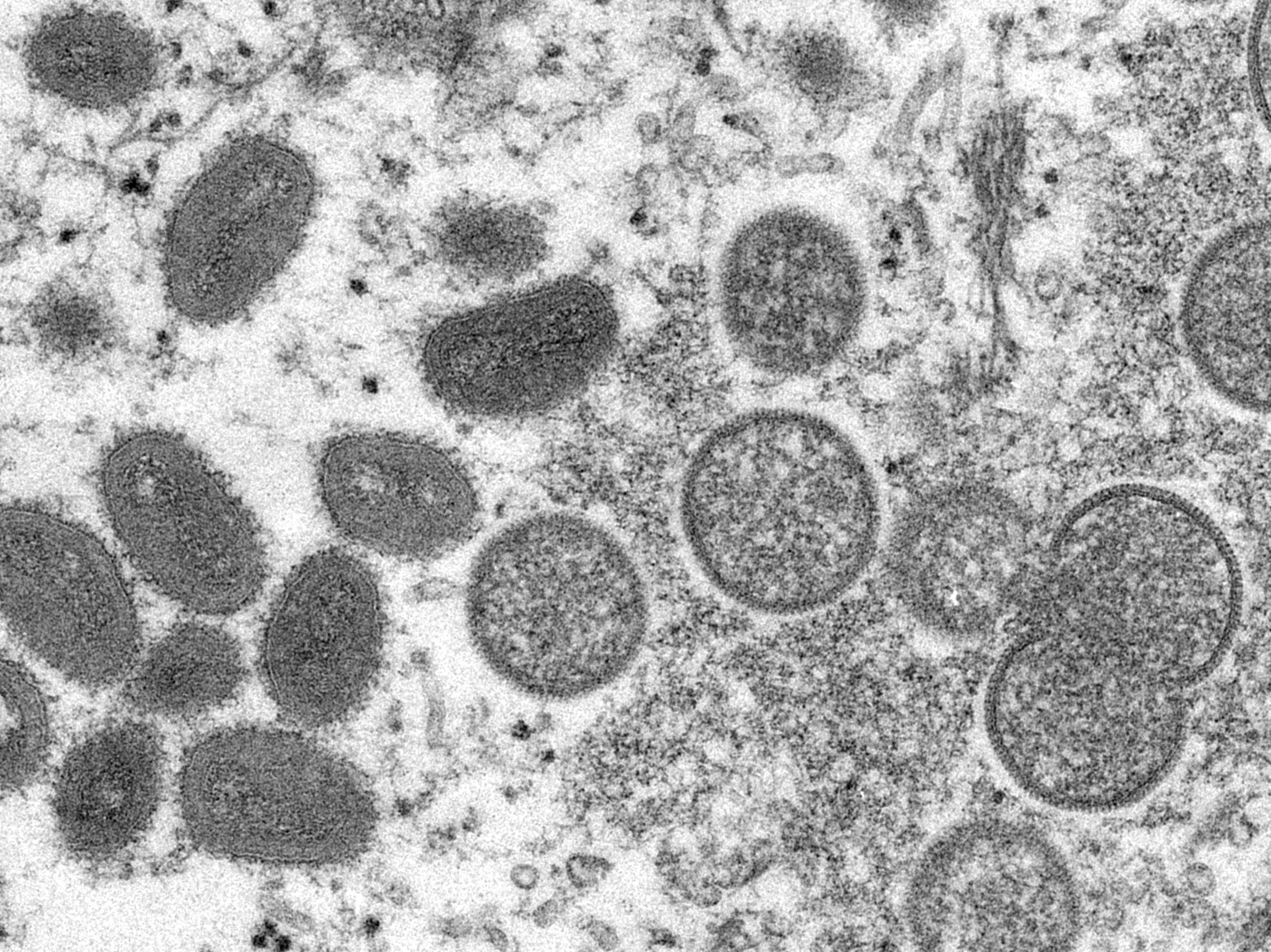 An electron microscopic image shows mature, oval-shaped monkeypox virus particles