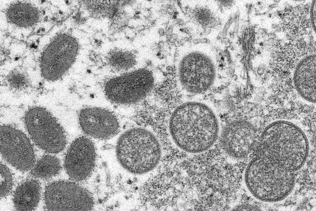 <p>Una imagen de microscopio electrónico muestra partículas maduras y ovaladas del virus de la viruela del mono</p>