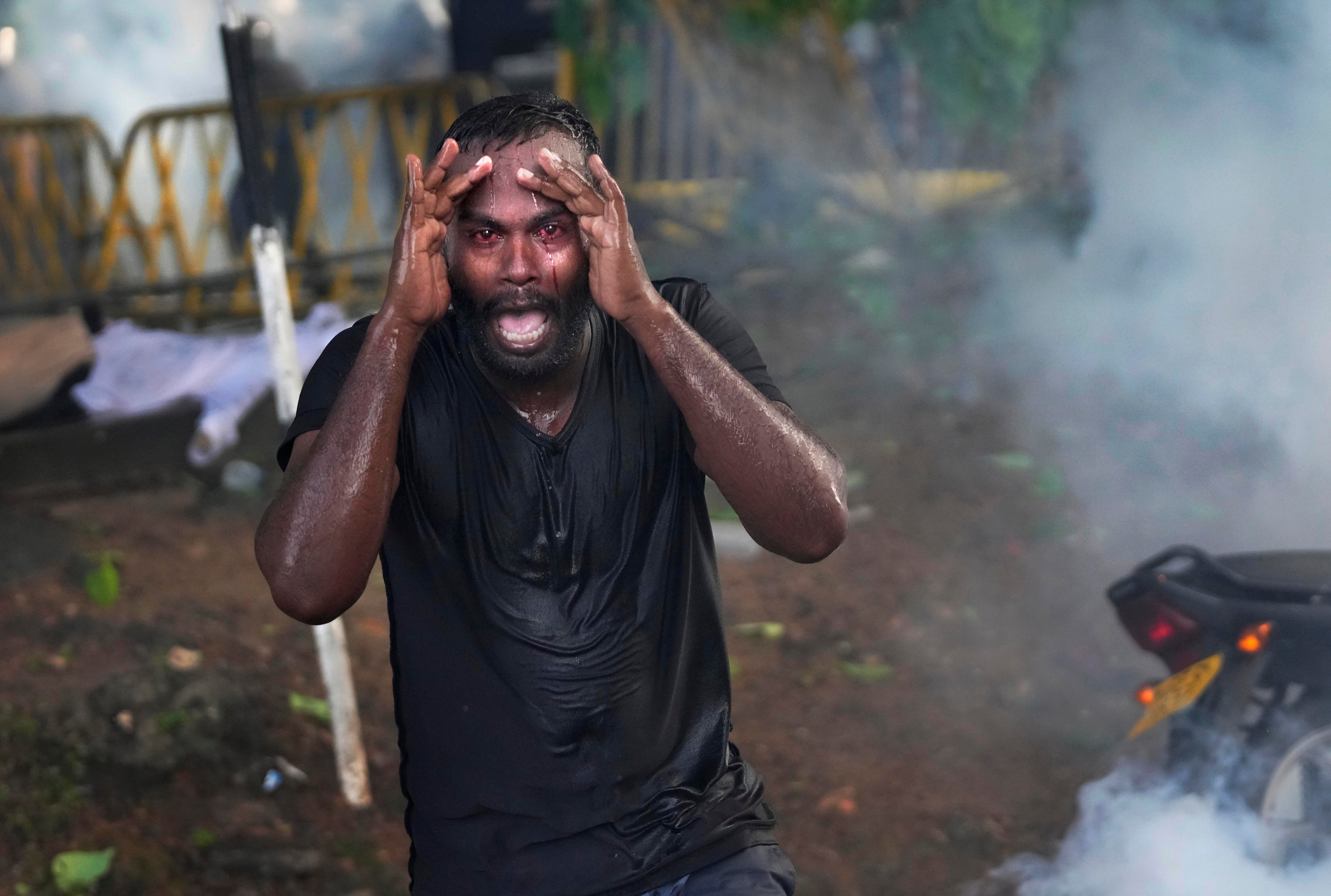 <p>An injured protester shouts in pain as police fire tear gas to disperse protesting members of the Inter University Students Federation during an anti government protest in Colombo on 19 May</p>