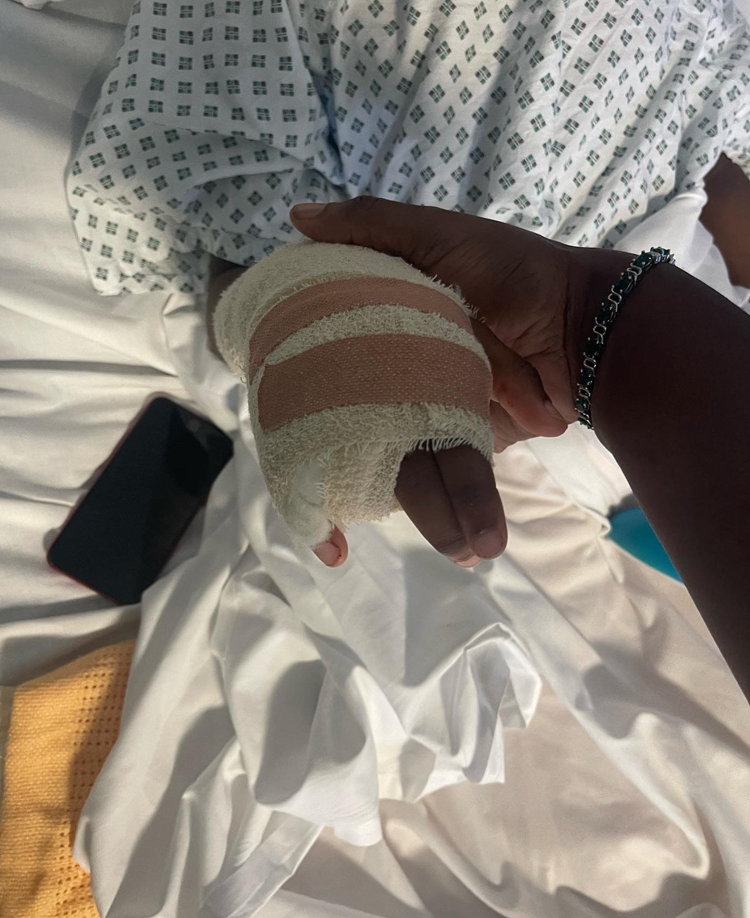 Doctors battled to save Raheem’s finger but were unsuccessful