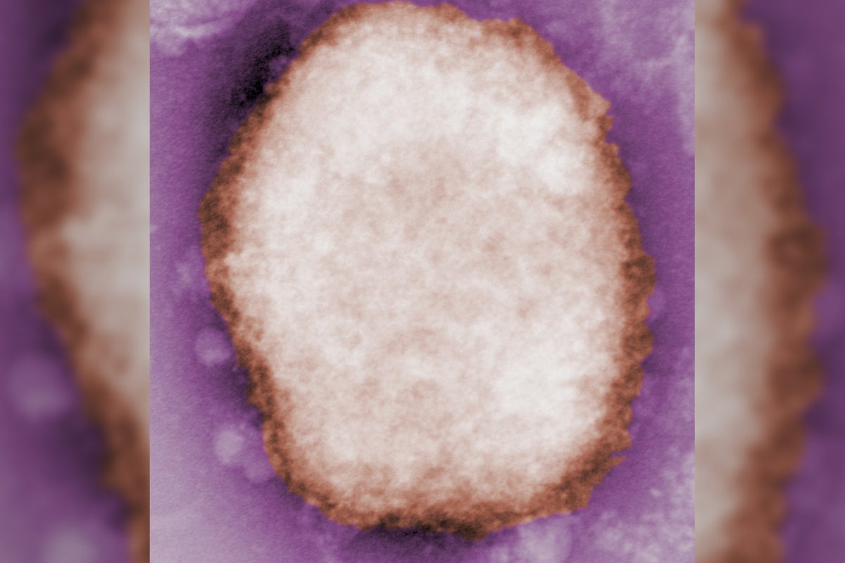37 new cases of monkey pox found in UK