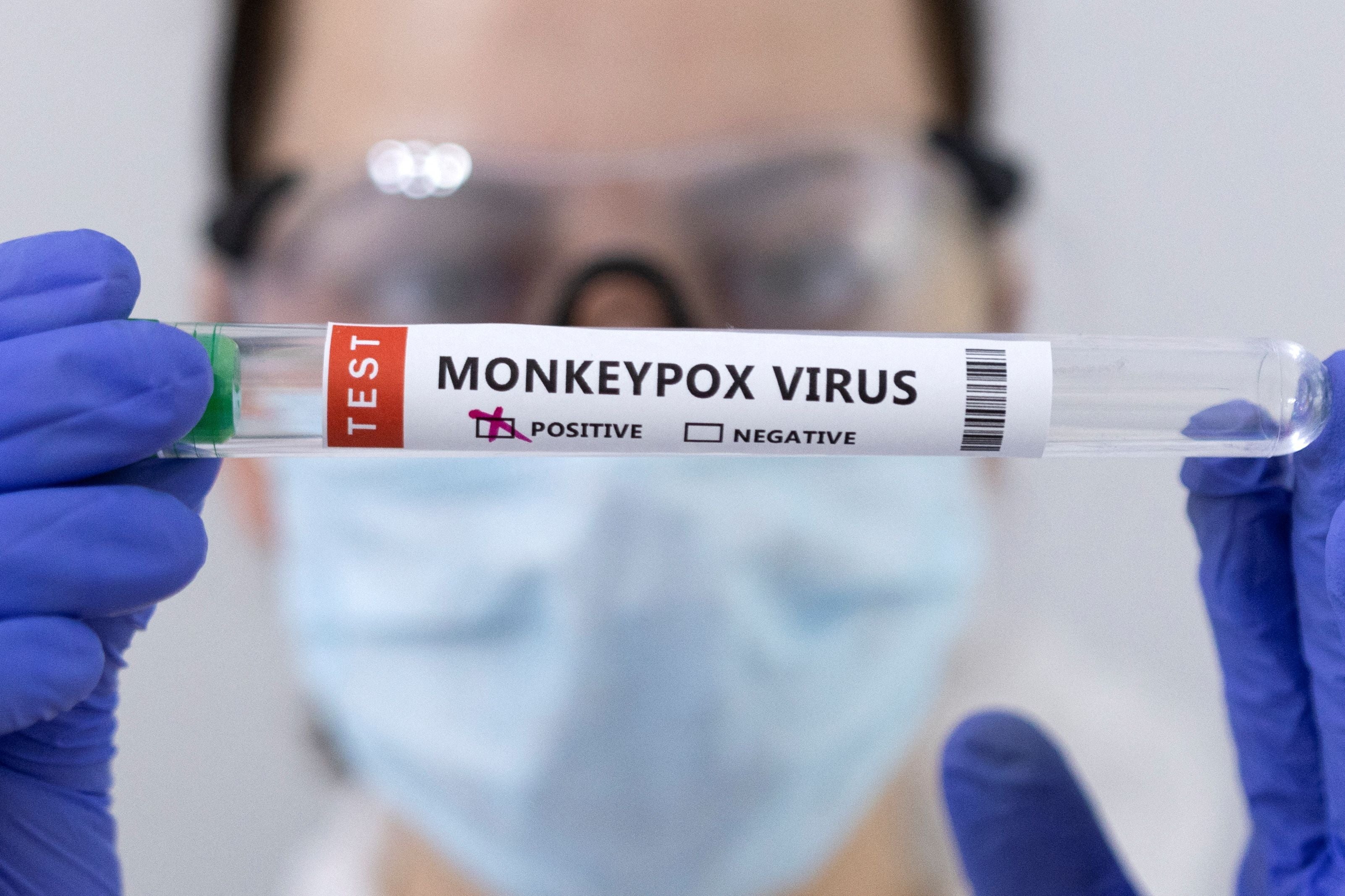 Test tubes labelled ‘Monkeypox virus positive’ are seen in this illustration taken 23 May 2022