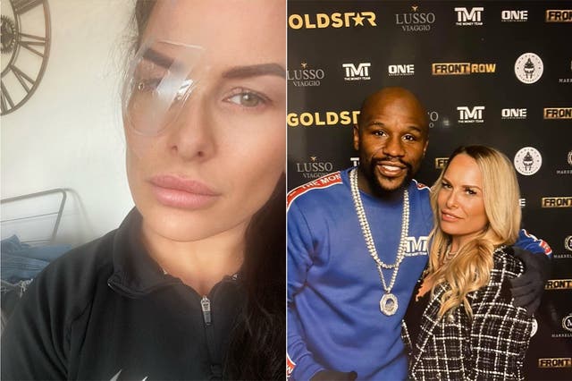 Cheryl Wilson post surgery and with Floyd Mayweather (Collect/ PA Real Life)