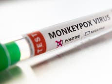 Washington and California report suspected Monkeypox cases as US outbreak widens
