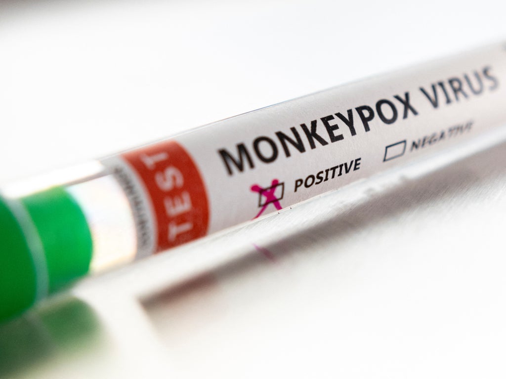 Washington and California report suspected Monkeypox cases as US outbreak widens