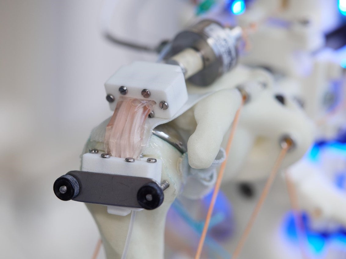 Human tendon tissue grown with the robotic system